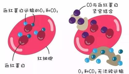警惕洗澡季隱形殺手 一氧化碳中毒康復后，當心遲發性腦病